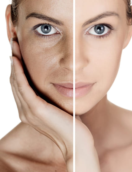 http://www.phoenixcosmeticcentre.com/pigmentation-detanning